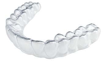 ClearCorrect Orthodontic Aligner - Mallette Dental